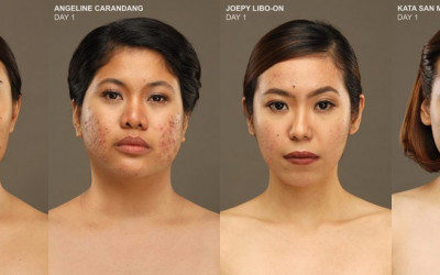 Maxi-Peel Encourages Women with Troubled Skin: "'Wag Mong Isuko Ang Laban!"